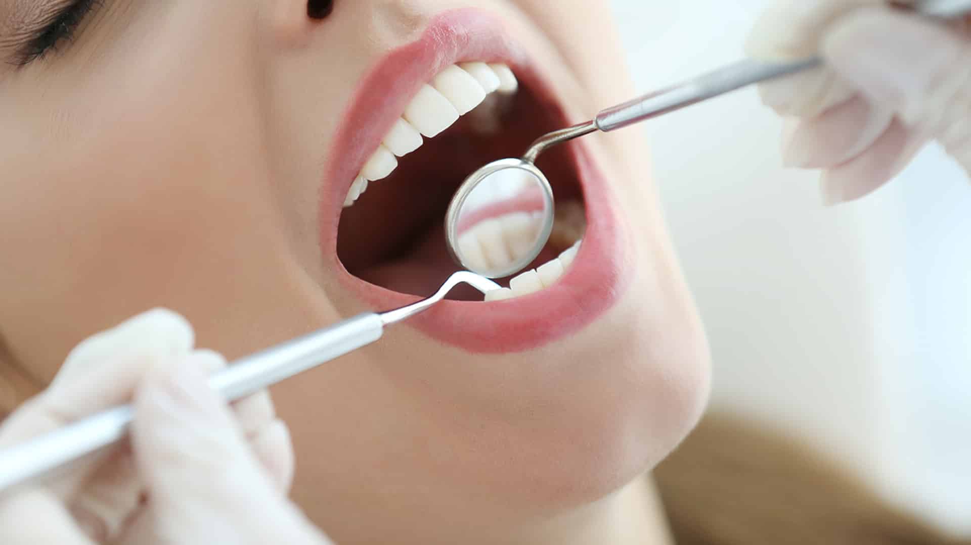 Professional Dental Cleanings available in Brentwood, TN