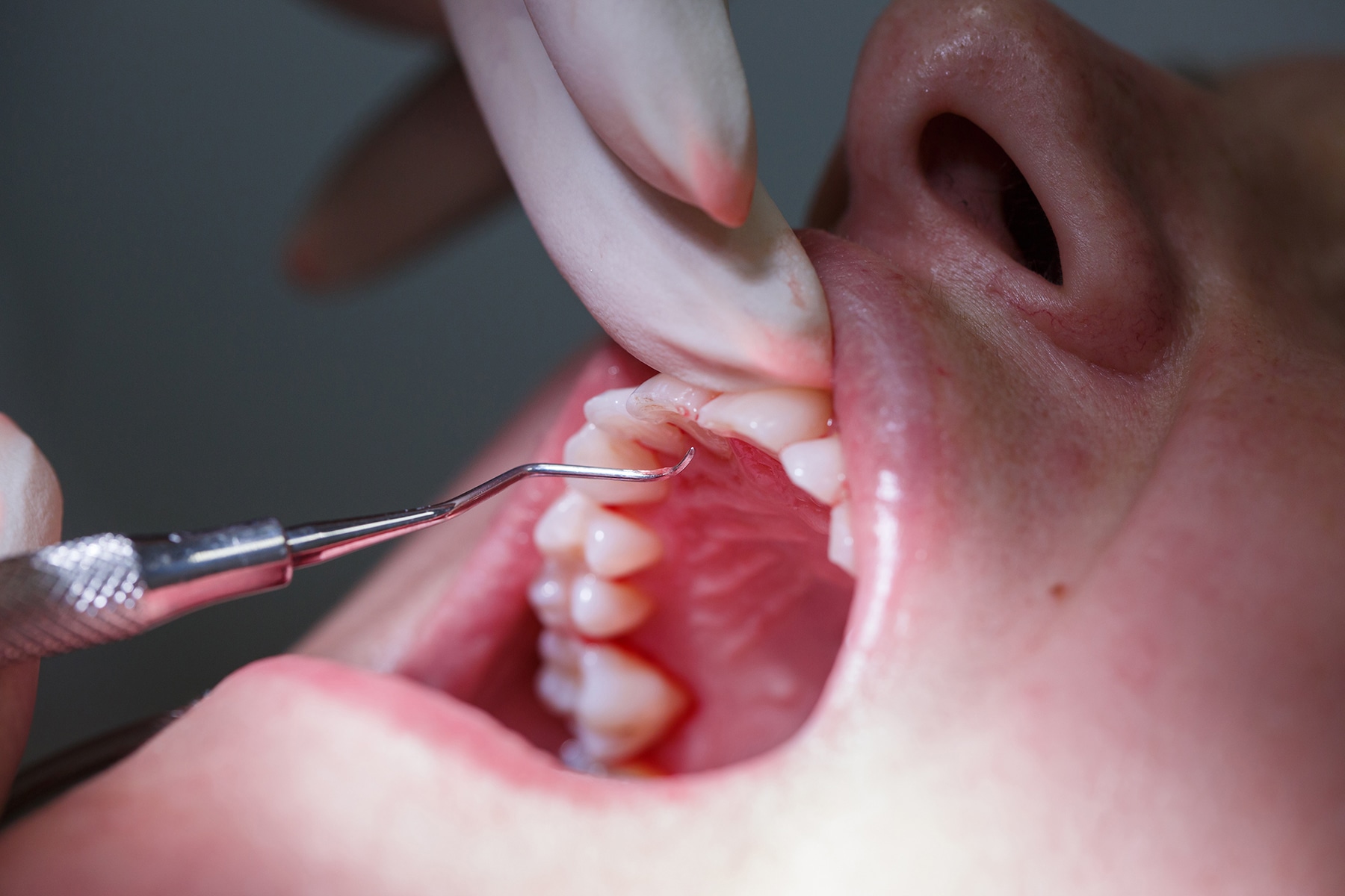 Periodontal cleaning in Brentwood, TN